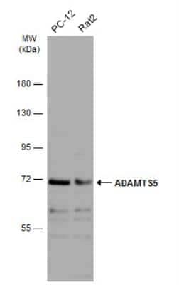 Western Blot: ADAMTS5 Antibody [NBP2-15286]