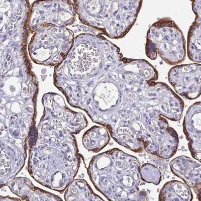 Immunohistochemistry-Paraffin: ADAMTS6 Antibody [NBP2-38510]