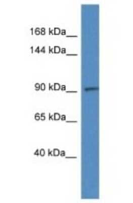 Western Blot: ADAMTS6 Antibody [NBP1-79877]