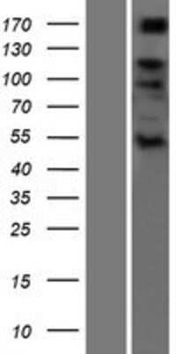 Western Blot: ADAMTS6 Overexpression Lysate [NBP2-04759]