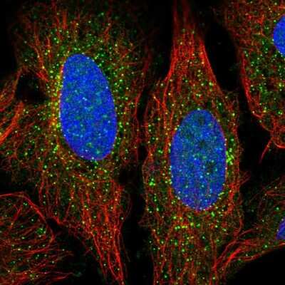 Immunocytochemistry/ Immunofluorescence: ADAMTS7 Antibody [NBP2-55554]