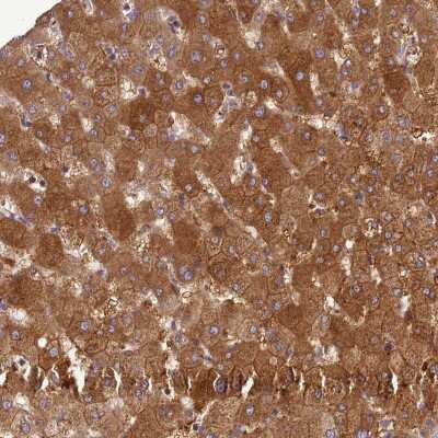 Immunohistochemistry: ADAMTS7 Antibody [NBP2-38539]