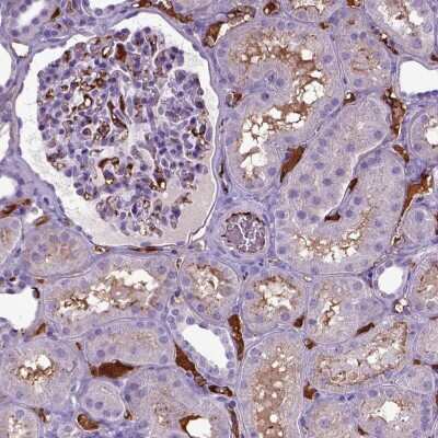 Immunohistochemistry: ADAMTS8 Antibody [NBP2-49480]