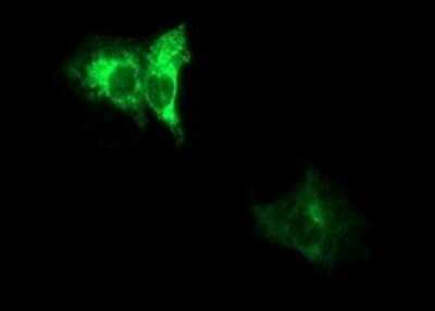 Immunocytochemistry/ Immunofluorescence: ADAMTS8 Antibody (OTI2H5) - Azide and BSA Free [NBP2-71677]