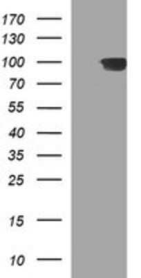 Western Blot: ADAMTS8 Antibody (OTI2H5)Azide and BSA Free [NBP2-71677]