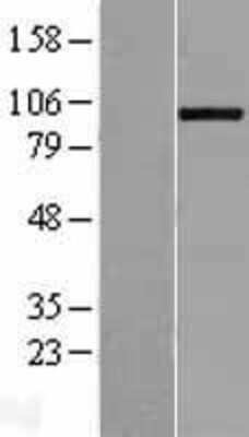 Western Blot: ADAMTS8 Overexpression Lysate [NBL1-07318]