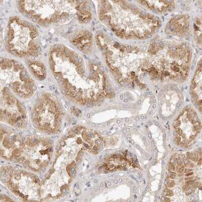 Immunohistochemistry-Paraffin: ADAMTS9 Antibody [NBP1-82915]