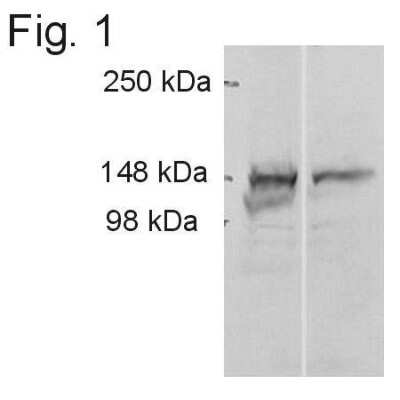 Western Blot: ADAMTS9 Antibody [NB100-74345]