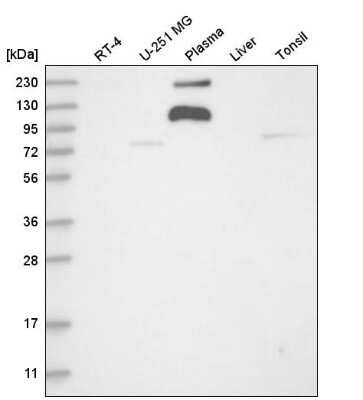 Western Blot: ADAMTS9 Antibody [NBP1-82916]