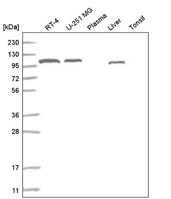 Western Blot: ADAMTS9 Antibody [NBP2-55347]