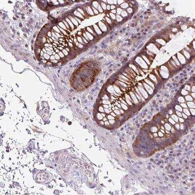 Immunohistochemistry: ADAMTSL2 Antibody [NBP2-46816]