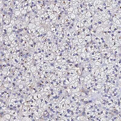 Immunohistochemistry-Paraffin: ADAMTSL2 Antibody [NBP2-14798]