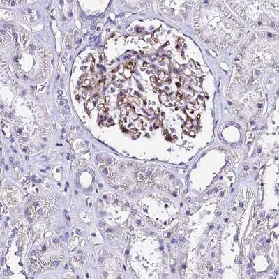 Immunohistochemistry-Paraffin: ADAMTSL2 Antibody [NBP2-14798]