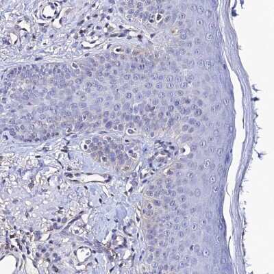 Immunohistochemistry-Paraffin: ADAMTSL2 Antibody [NBP2-14798]