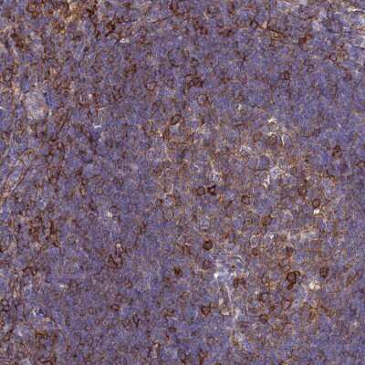 Immunohistochemistry-Paraffin: ADAMTSL2 Antibody [NBP2-14798]