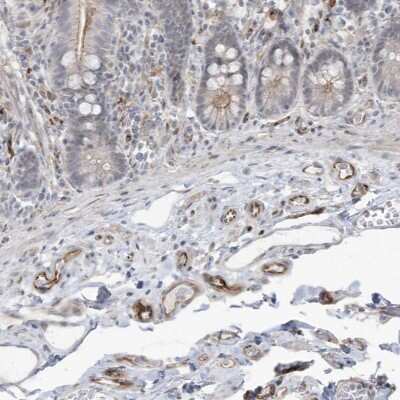 Immunohistochemistry: ADAMTSL3 Antibody [NBP2-48627]