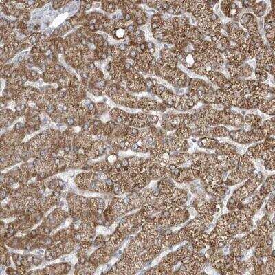 Immunohistochemistry-Paraffin: ADAMTSL3 Antibody [NBP1-81426]