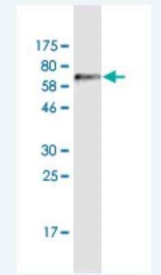 Western Blot: ADAMTSL4 Antibody (2H7) [H00054507-M03]