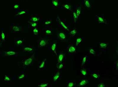 Immunocytochemistry/ Immunofluorescence: ADAMTSL4 Antibody [NBP3-05785]