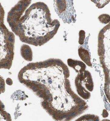 Immunohistochemistry-Paraffin: ADAMTSL4 Antibody [NBP1-84185]
