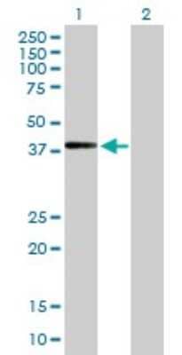 Western Blot: ADAMTSL4 Antibody [H00054507-B01P]