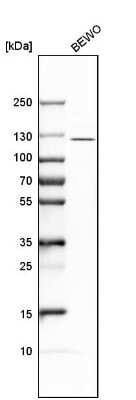 Western Blot: ADAMTSL4 Antibody [NBP1-84185]