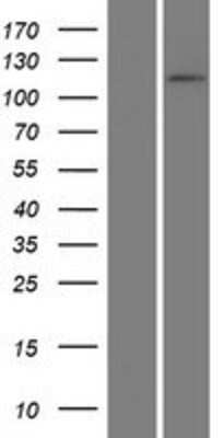 Western Blot: ADAMTSL4 Overexpression Lysate [NBP2-06735]