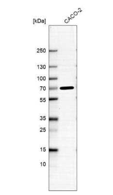 Western Blot: ADAMTSL5 Antibody [NBP1-93438]