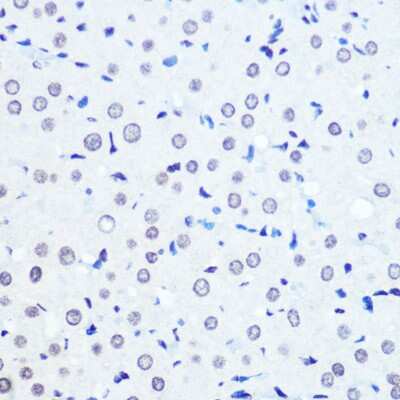 Immunohistochemistry-Paraffin: ADAR Antibody (7H1U2) [NBP3-15383]