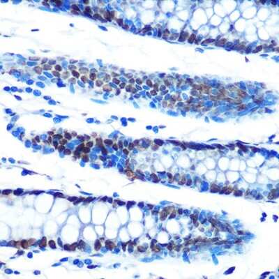 Immunohistochemistry-Paraffin: ADAR Antibody (7H1U2) [NBP3-15383]