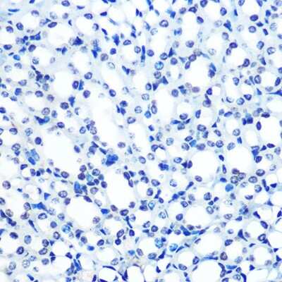 Immunohistochemistry-Paraffin: ADAR Antibody (7H1U2) [NBP3-15383]