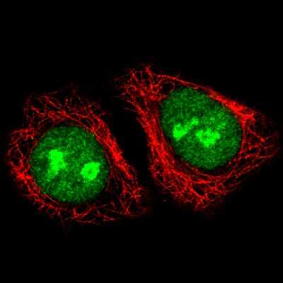 Immunocytochemistry/ Immunofluorescence: ADAR Antibody (CL0176) [NBP3-05500]