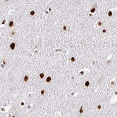 Immunohistochemistry-Paraffin: ADAR Antibody (CL0176) [NBP3-05500]