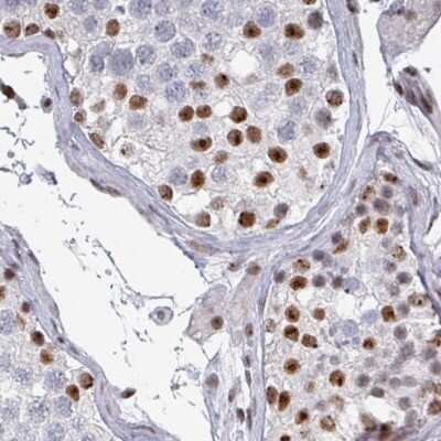 Immunohistochemistry-Paraffin: ADAR Antibody (CL0176) [NBP3-05500]