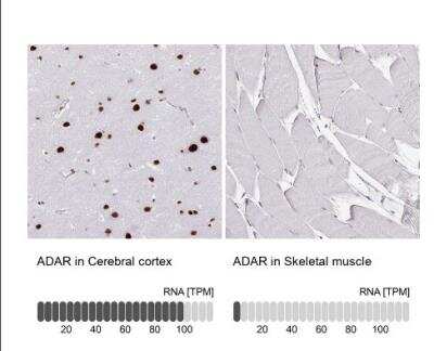 Immunohistochemistry-Paraffin: ADAR Antibody (CL0176) [NBP3-05500]