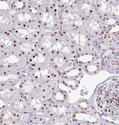 Immunohistochemistry-Paraffin: ADAR Antibody (CL0176) [NBP3-05500]