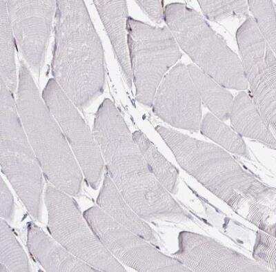Immunohistochemistry-Paraffin: ADAR Antibody (CL0176) [NBP3-05500]