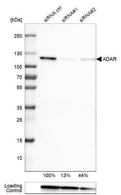 Western Blot: ADAR Antibody (CL0176) [NBP3-05500]