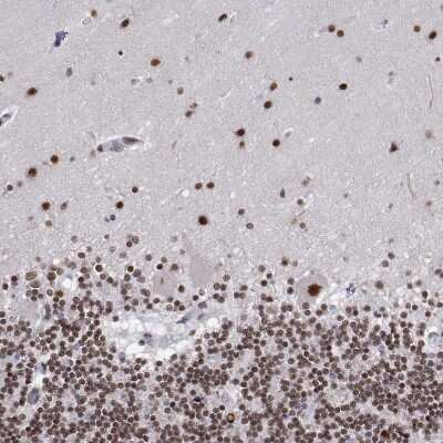 Immunohistochemistry-Paraffin: ADAR Antibody [NBP1-90242]