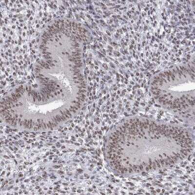 Immunohistochemistry-Paraffin: ADAR Antibody [NBP1-90242]