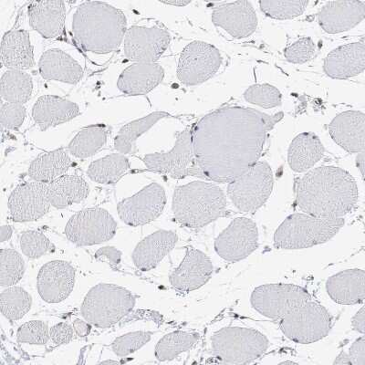 Immunohistochemistry-Paraffin: ADAR Antibody [NBP1-90242]