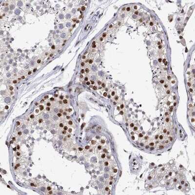 Immunohistochemistry-Paraffin: ADAR Antibody [NBP1-90242]