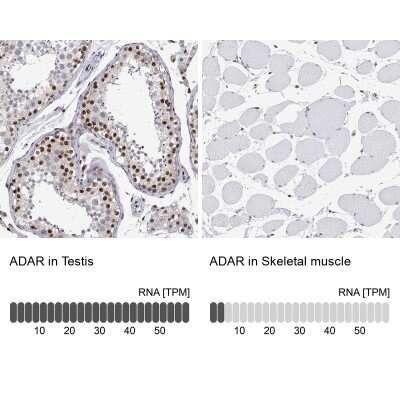 Immunohistochemistry-Paraffin: ADAR Antibody [NBP1-90242]