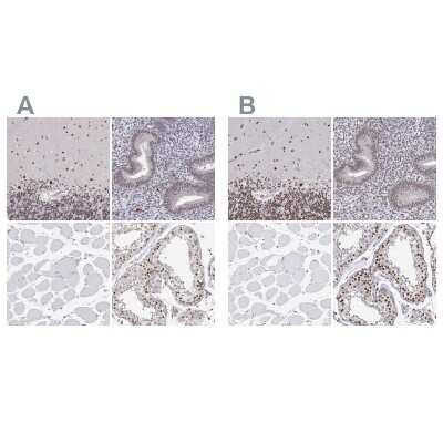 Immunohistochemistry-Paraffin: ADAR Antibody [NBP3-05523]