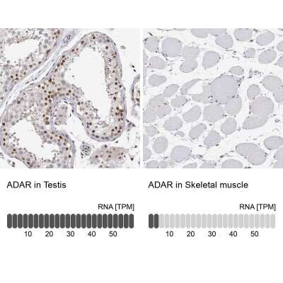 Immunohistochemistry-Paraffin: ADAR Antibody [NBP3-05523]