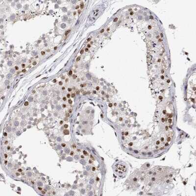 Immunohistochemistry-Paraffin: ADAR Antibody [NBP3-05523]