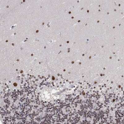 Immunohistochemistry-Paraffin: ADAR Antibody [NBP3-05523]