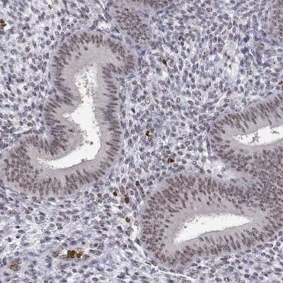 Immunohistochemistry-Paraffin: ADAR Antibody [NBP3-05523]
