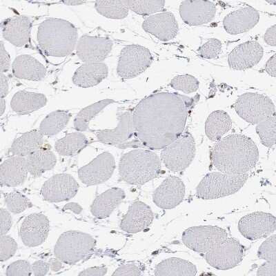 Immunohistochemistry-Paraffin: ADAR Antibody [NBP3-05523]