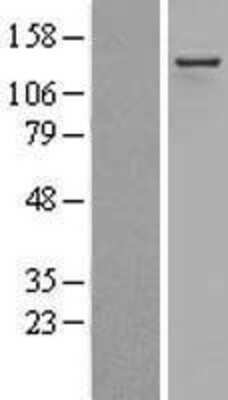 Western Blot: ADAR Overexpression Lysate [NBL1-07321]